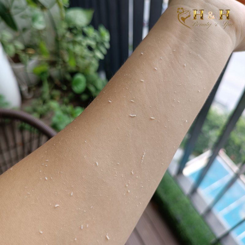 Hình ảnh trải nghiệm Esthepro 119